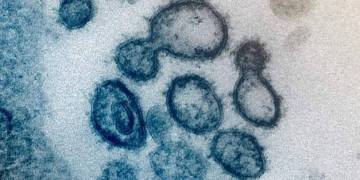 Alberta coronavirus cases jump to 19, one patient visited Edmonton hospital before testing positive