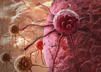 World Cancer Day on February 4: Chronic inflammation can up the risk
