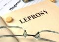 Leprosy - know the facts about this disease | TheHealthSite.com