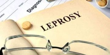 Leprosy - know the facts about this disease | TheHealthSite.com