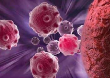 Cancer - know the side effects of radiation therapy | TheHealthSite.com